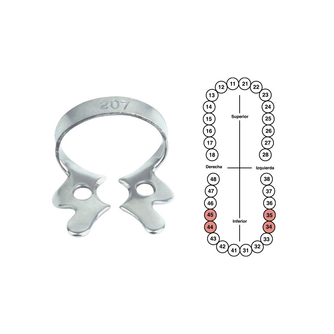 Grapa 207 para premolares inferiores 6B (G207)