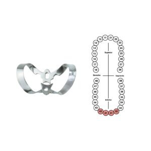 Grapa 210 para incisivos inferiores 6B (G210)