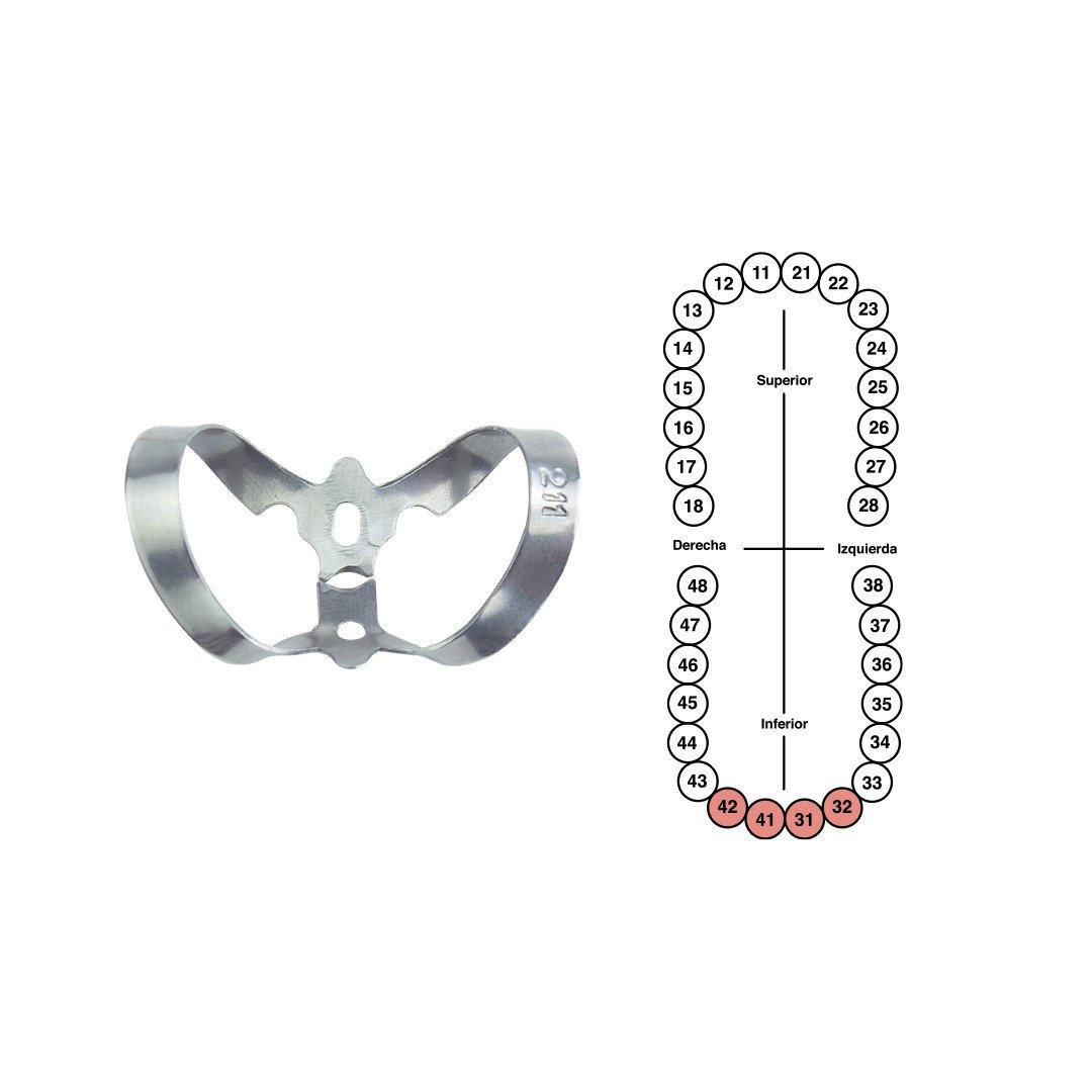 Grapa 211 para incisivos inferiores 6B (G211)