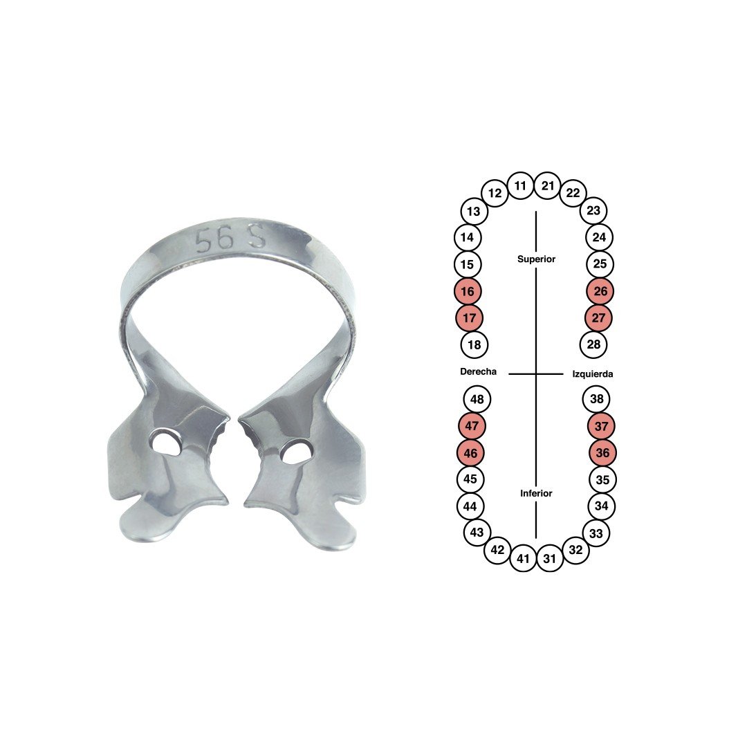 Grapa 56S para molares superiores 6B (GP56S)