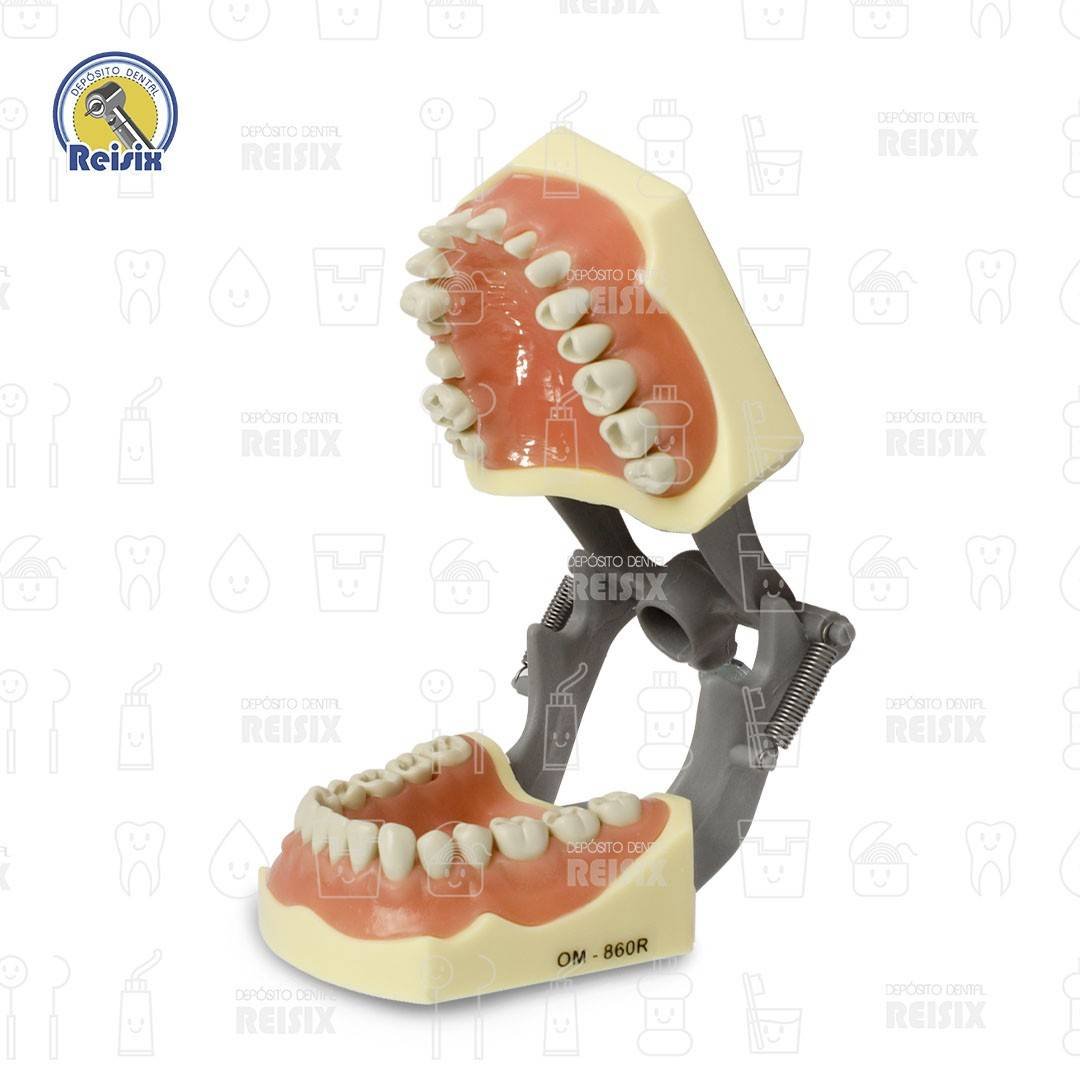 Tipodonto tipo Columbia con cavidades